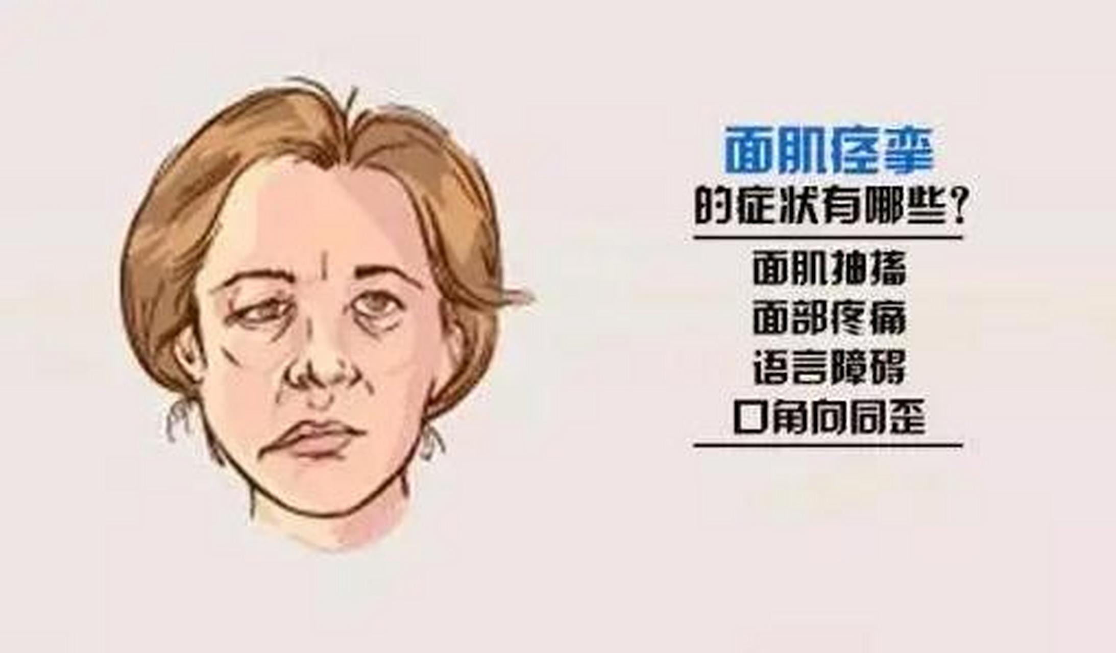 面肌痉挛最新最好治疗方法,面肌痉挛最新最好治疗方法