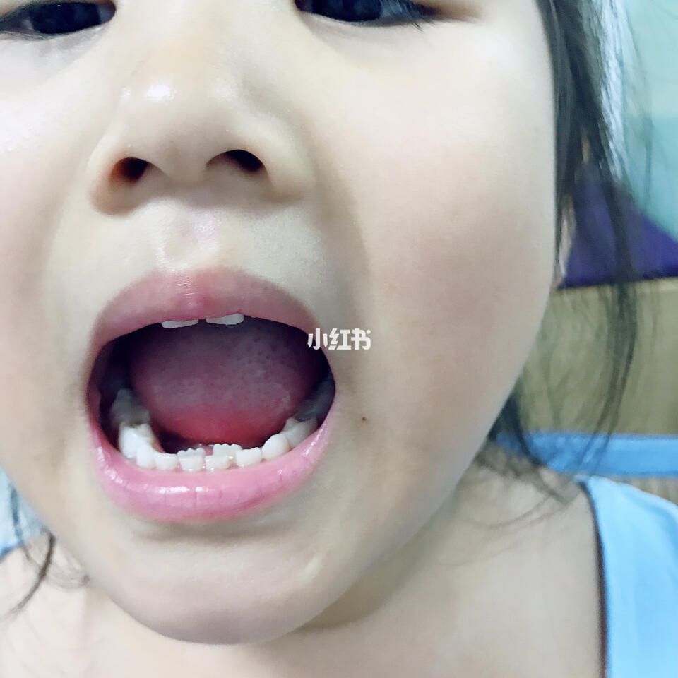 最新小孩拔牙哭闹视频与科技产品介绍文案精选